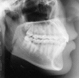 Radiologia Odontológica em Recife